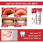معجون اسنان sp6