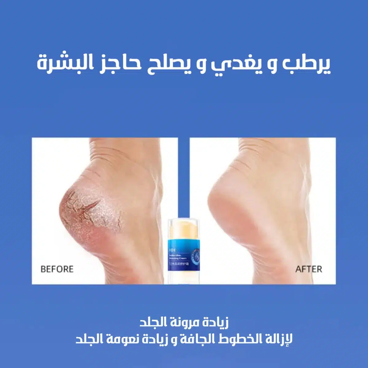 ستيك مرطب للقدمين و لليدين يوفر ترطيب عميق
