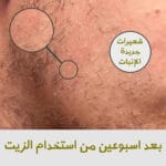 ⁦مجموعة اللحية المثالية⁩ - الصورة ⁦10⁩